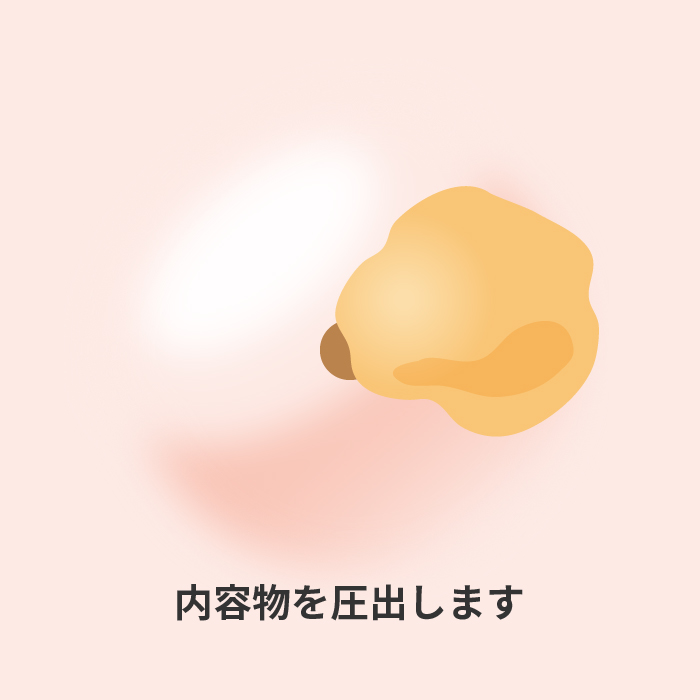 内容物を圧出します